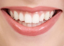 dental health