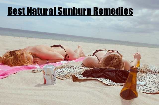 22 Great Natural Sunburn Remedies To Stop The Pain