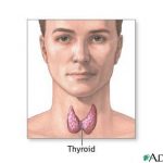 Natural thyroid storm treatments