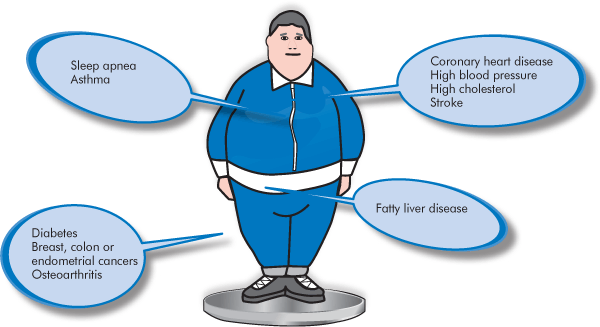 10 Health Risks of Being Overweight or Obese