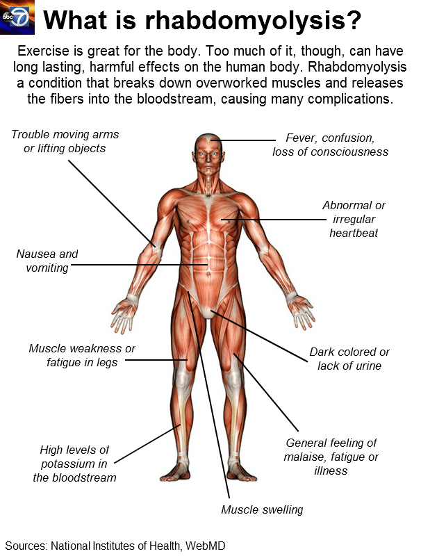 Symptoms of Rhabdomyolysis